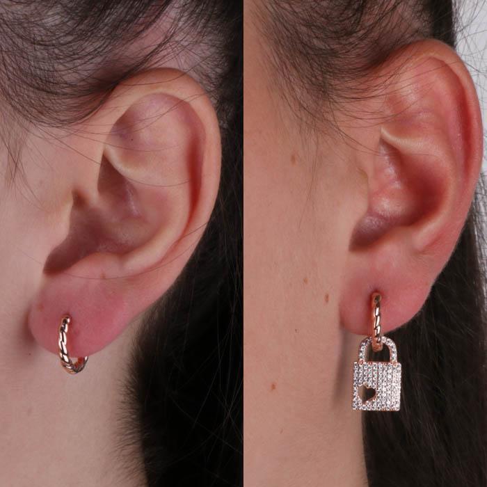 Boucles d'oreilles en argent 925