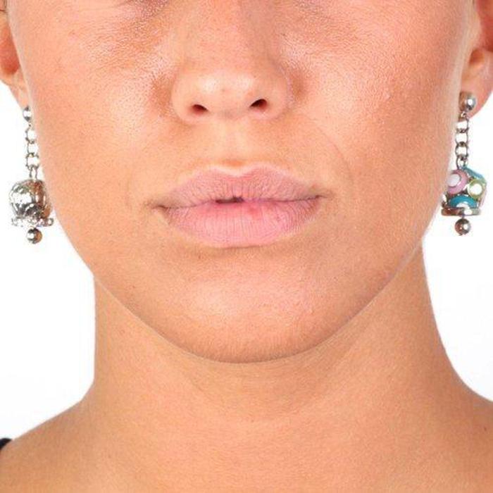 Metal Earrings