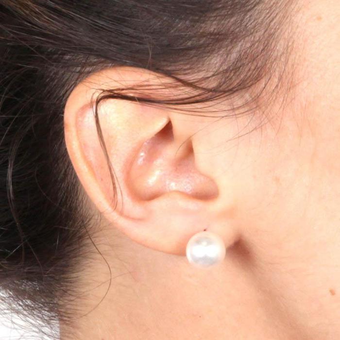 Orecchini In Argento 925